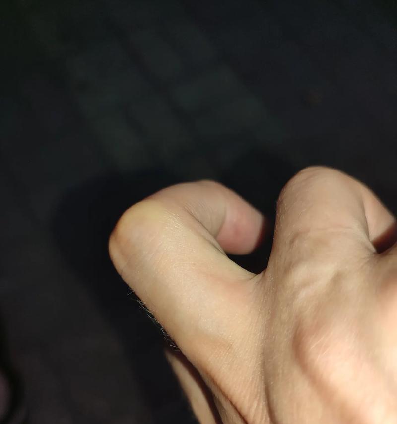 如何处理被小猫咪抓破口？（有效的护理方法让伤口迅速愈合）