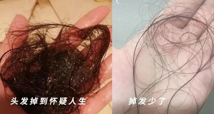 如何帮助狗妈妈度过低血钙期（宠物爱好者必读，让你的狗妈妈健康长寿）