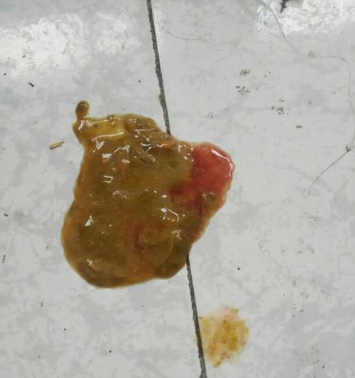 小狗儿拉肚子的原因及预防措施（了解拉肚子的主要原因，保护宠物的健康）