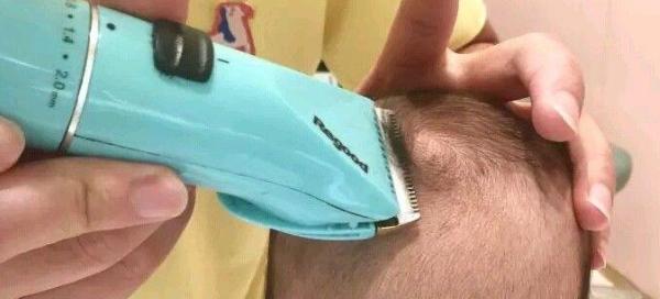 胎毛剃除（选择合适的工具和技巧确保剃除胎毛的安全与效果）
