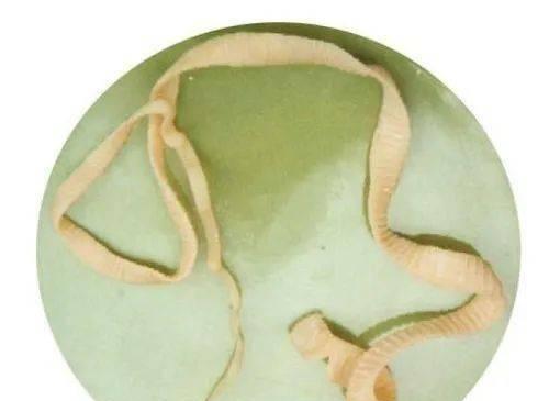狗狗肛门虫子该吃什么药？（探寻有效治疗肛门虫子的药物与方法）