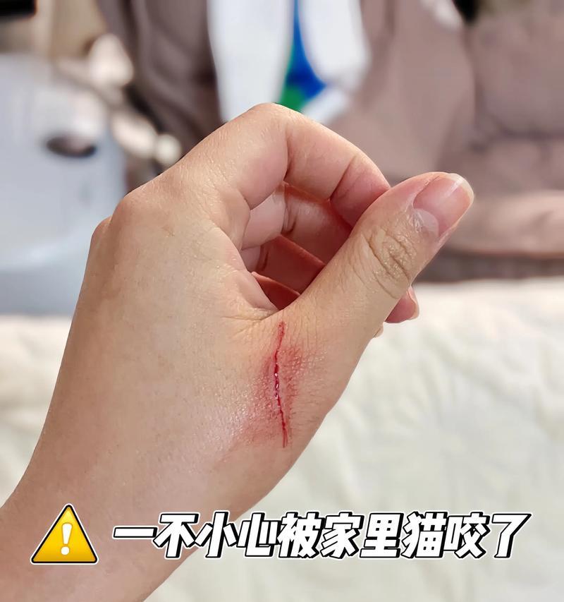 狗狗抓伤后打针的有效期（探究狗狗抓伤后打针的持续保护时间）