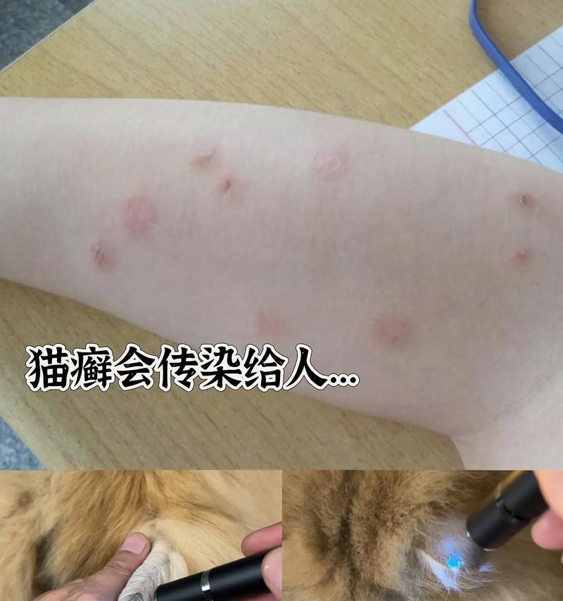 猫癣（了解猫癣的症状、有效治疗方法和预防措施）