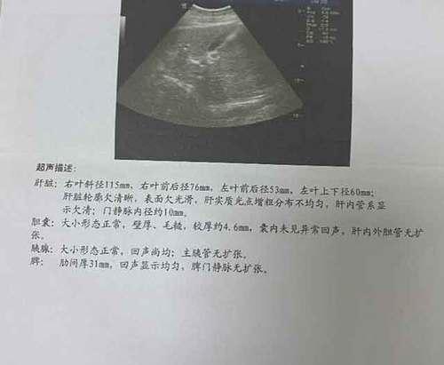 狗狗肝硬化（探索狗狗肝硬化康复的关键因素和预计疗程长度）