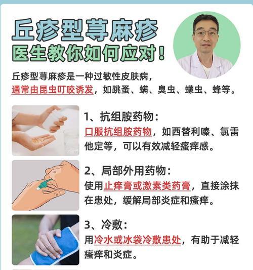 狗狗荨麻疹的症状及治疗方法（了解荨麻疹的症状和有效的治疗方法）