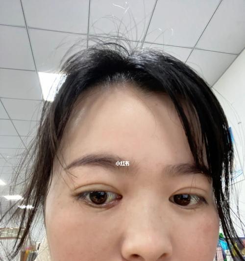 松狮倒睫手术的康复时间及注意事项（了解松狮倒睫手术的恢复过程，帮助宠物尽快康复）