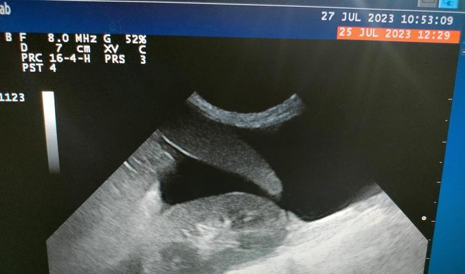 狗腹腔积水（了解狗腹腔积水的常见表现和治疗方法）
