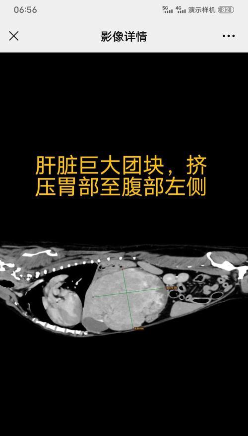狗狗胀气（解析狗狗胀气的种类及适用的治疗方法）