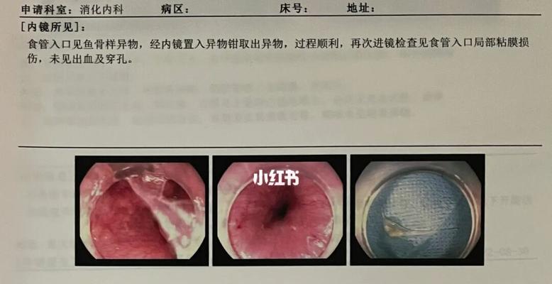 小狗卡喉生命垂危，紧急救援的关键一刻（卡喉致命的时间窗口有多长？怎样进行急救？）
